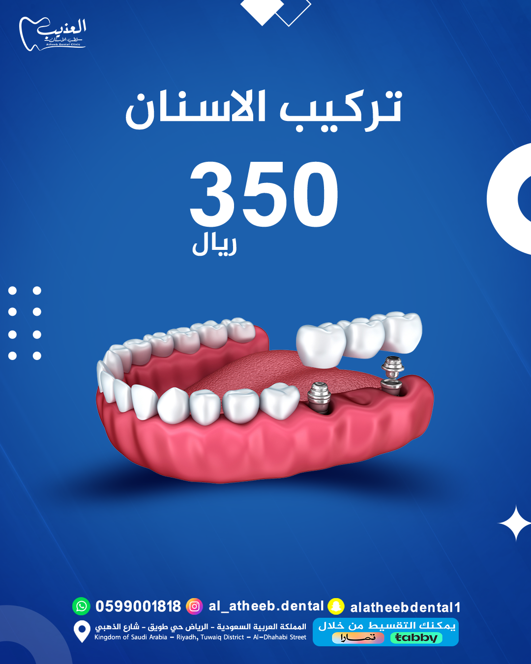 تصاميم السوشيال ميديا لعيادة عذيب لطب الأسنان - صورة 5